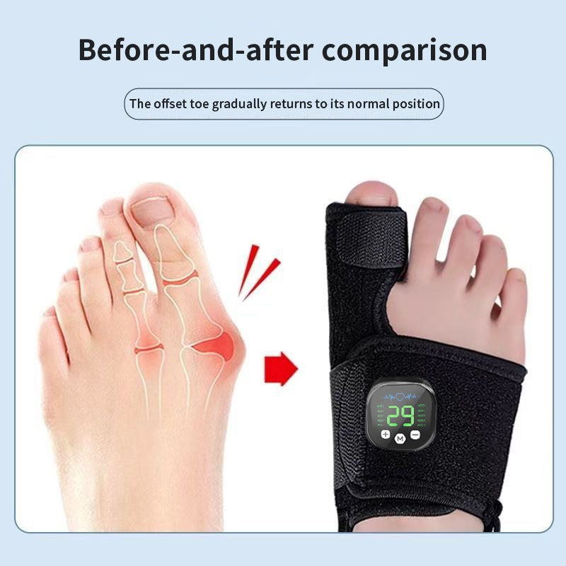 Bunion Relief Toe Separator GidgetBox